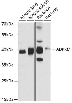 Anti-ADPRM Antibody