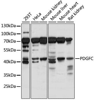 Anti-PDGFC Antibody