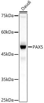 Anti-PAX5 Antibody