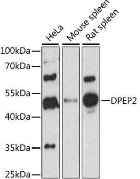 Anti-DPEP2 Antibody