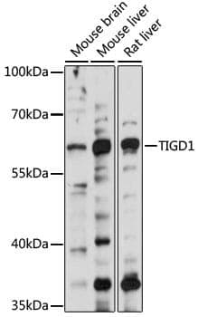 Anti-TIGD1 Antibody