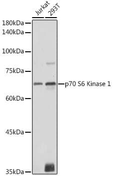 Anti-RPS6KB1 Antibody
