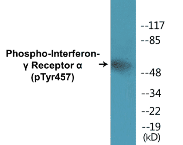 Interferon gamma Receptor alpha (phospho Tyr457) Cell Based ELISA Kit