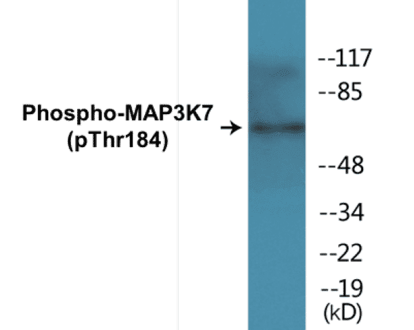 MAP3K7 (phospho Thr184) Cell Based ELISA Kit
