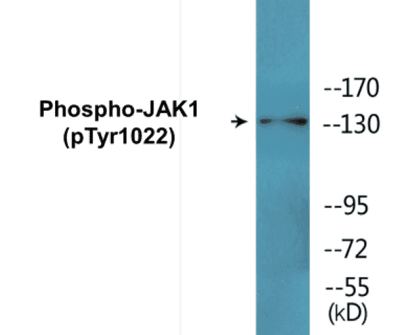 JAK1 (phospho Tyr1022) Cell Based ELISA Kit
