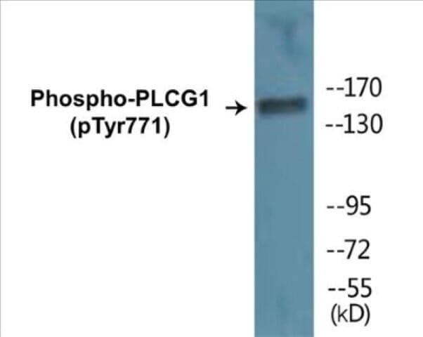 PLCG1 (phospho Tyr771) Cell Based ELISA Kit
