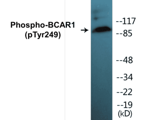 BCAR1 (phospho Tyr249) Cell Based ELISA Kit