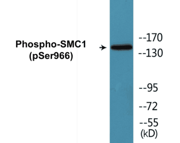 SMC1 (phospho Ser966) Cell Based ELISA Kit