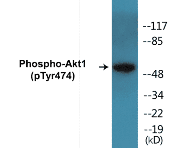 Akt1 (phospho Tyr474) Cell Based ELISA Kit