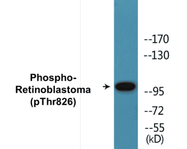 Retinoblastoma (phospho Thr826) Cell Based ELISA Kit