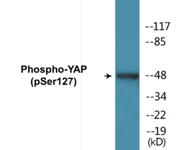 YAP (phospho Ser127) Cell Based ELISA Kit