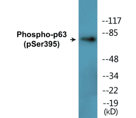 p63 (phospho Ser395) Cell Based ELISA Kit