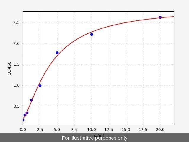 Human TGT (tRNA-Guanine Transglycosylase) ELISA Kit