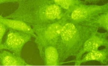 Anti-Rad18 Antibody