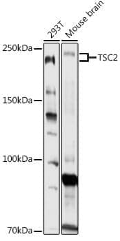 Anti-TSC2 Antibody