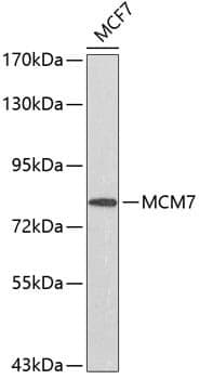 Anti-MCM7 Antibody