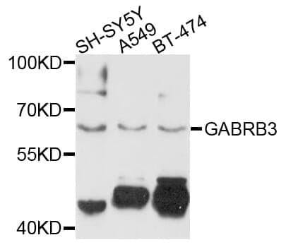 Anti-GABRB3 Antibody