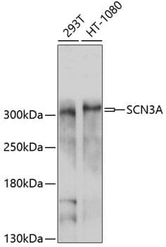 Anti-SCN3A Antibody