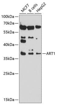 Anti-ART1 Antibody