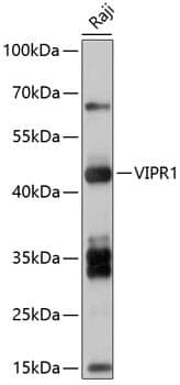 Anti-VIPR1 Antibody