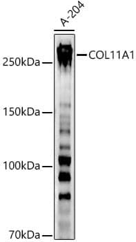 Anti-COL11A1 Antibody