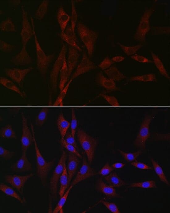 Anti-CACNA1H Antibody