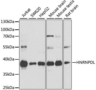 Anti-HNRNPDL Antibody