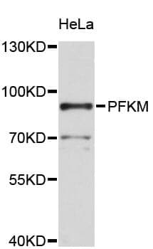 Anti-PFKM Antibody
