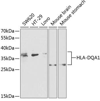 Anti-HLA-DQA1 Antibody