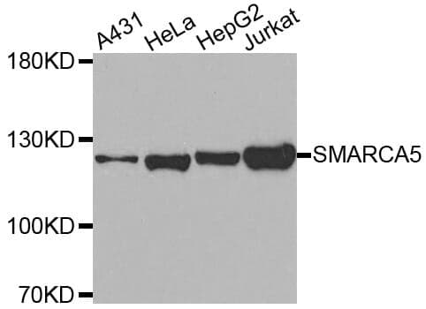 Anti-SMARCA5 Antibody