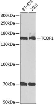Anti-TCOF1 Antibody