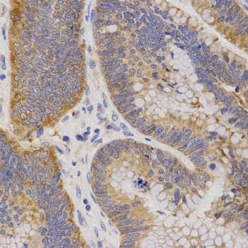 Anti-P2RY11 Antibody - Identical to Abcam (ab180739)