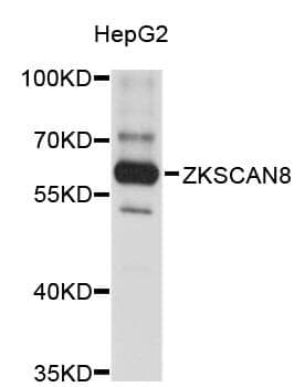 Anti-ZKSCAN8 Antibody