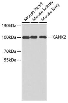 Anti-KANK2 Antibody