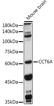 Anti-CCT6A Antibody
