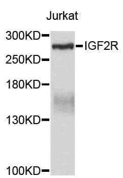 Anti-IGF2R Antibody