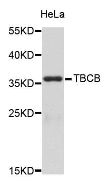 Anti-TBCB Antibody