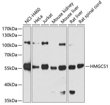 Anti-HMGCS1 Antibody