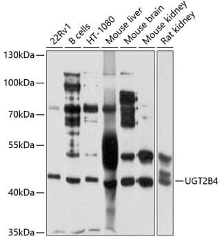Anti-UGT2B4 Antibody