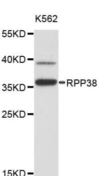 Anti-RPP38 Antibody