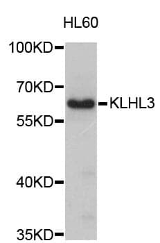 Anti-KLHL3 Antibody