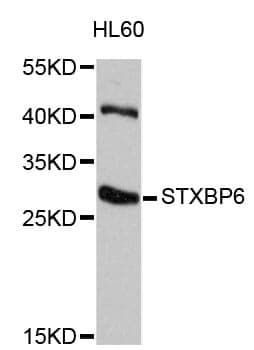 Anti-STXBP6 Antibody