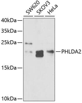 Anti-PHLDA2 Antibody