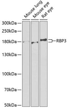 Anti-RBP3 Antibody