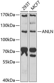 Anti-ANLN Antibody