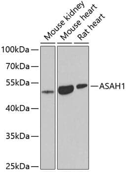 Anti-ASAH1 Antibody