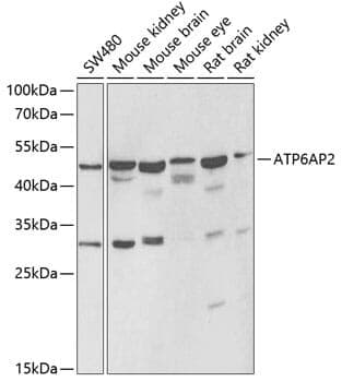 Anti-ATP6AP2 Antibody