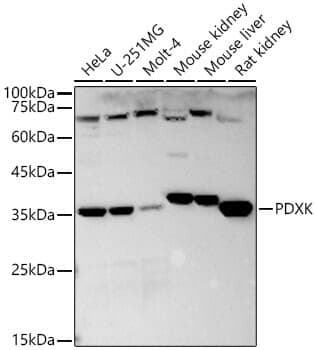 Anti-PDXK Antibody