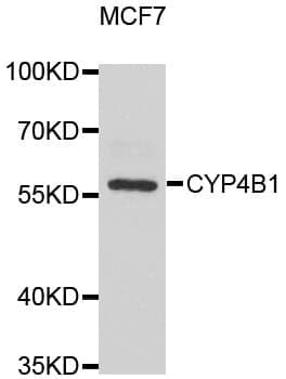 Anti-CYP4B1 Antibody