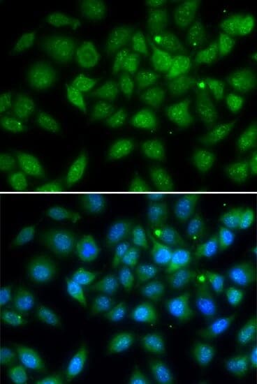 Anti-LELP1 Antibody